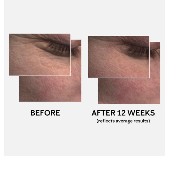 Mary Kay TimeWise Miracle Set 3D Normal / Dry - Picture 6 of 12